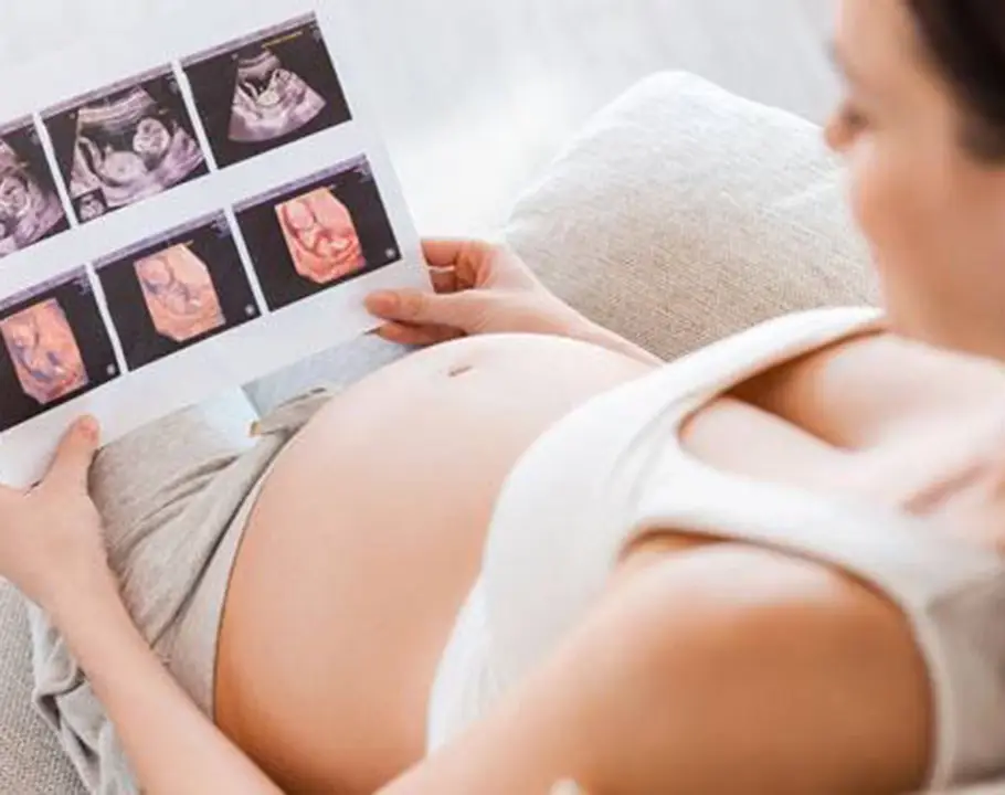 Symbolbild einer Schwangeren, die sich Ultraschallbilder vor den Bauch hält